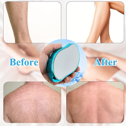 ✨ SmoothErase™ Crystal Hair & Skin Smoother – Painless Hair Removal + Gentle Exfoliation