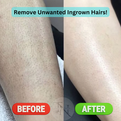 ✨ SmoothErase™ Crystal Hair & Skin Smoother – Painless Hair Removal + Gentle Exfoliation