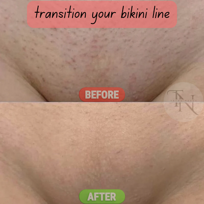 ✨ SmoothErase™ Crystal Hair & Skin Smoother – Painless Hair Removal + Gentle Exfoliation